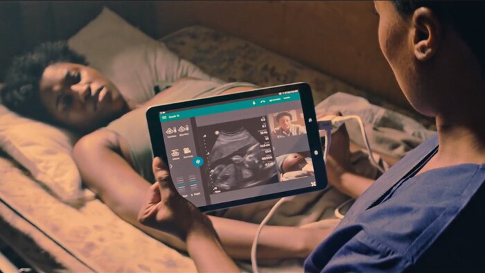 Philips Lumify integrated tele-ultrasound powered by Reacts