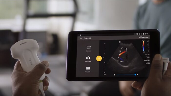 Lumify de Philips – L’échographie sur votre appareil intelligent compatible