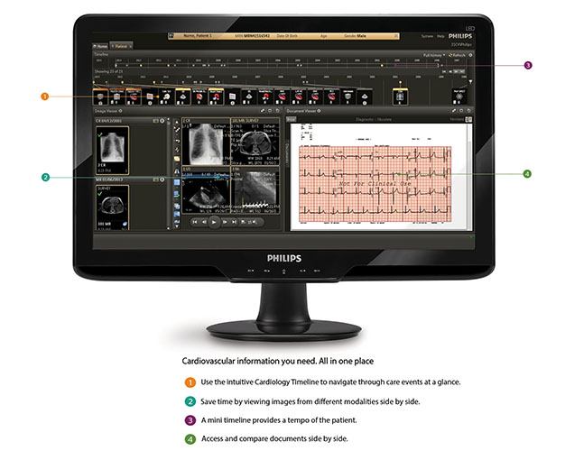Cardiology Informatics | Philips Healthcare | Cardiovascular ...