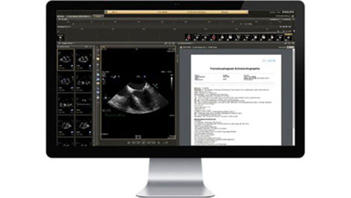 IntelliSpace Cardiovascular screen thumbnail