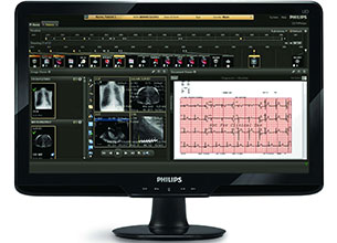 patients' cardiograph monitored on Philips CVIS informatics