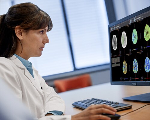 Female radiologist examining MRI perfusion images