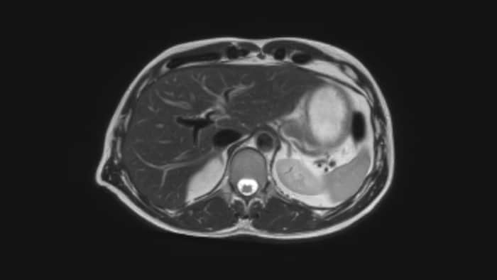 Image confiance diagnostique