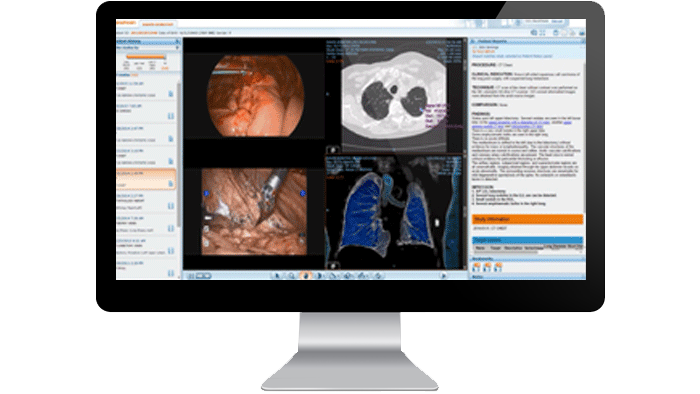 Clinical repository image on computer screen