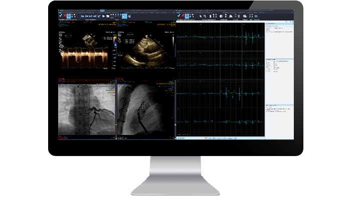 Cardiology module interface screen on a monitor