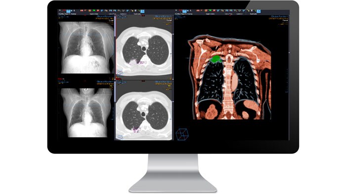 Radiology diagnostic module interface screen on a monitor