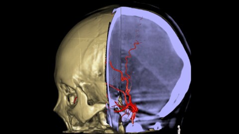 3D Roadmap anatomical references