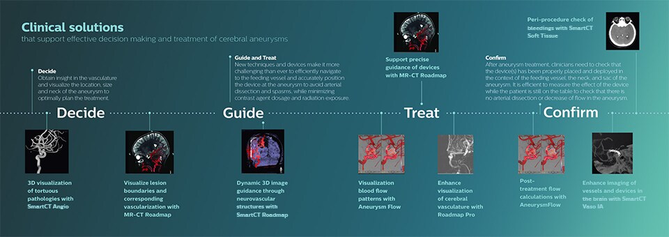 Clinical solutions for cerebral aneurysms download image