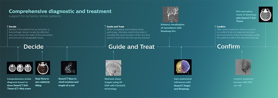 Clinical ischemic stroke solutions download image