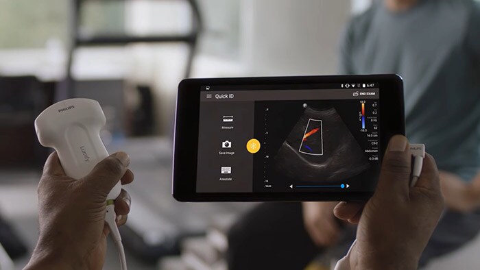 Philips Lumify - Ultrasound on your compatible smart device