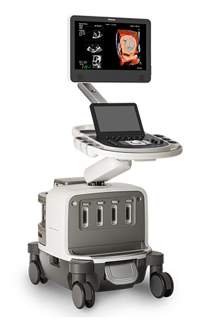 Epiq 7 ultrasound machine
