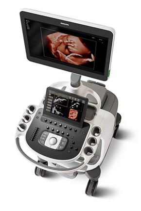 Epiq 7 ultrasound machine for obstetrics and gynecology