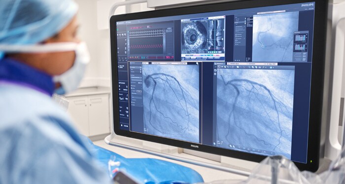 Interventional X-ray